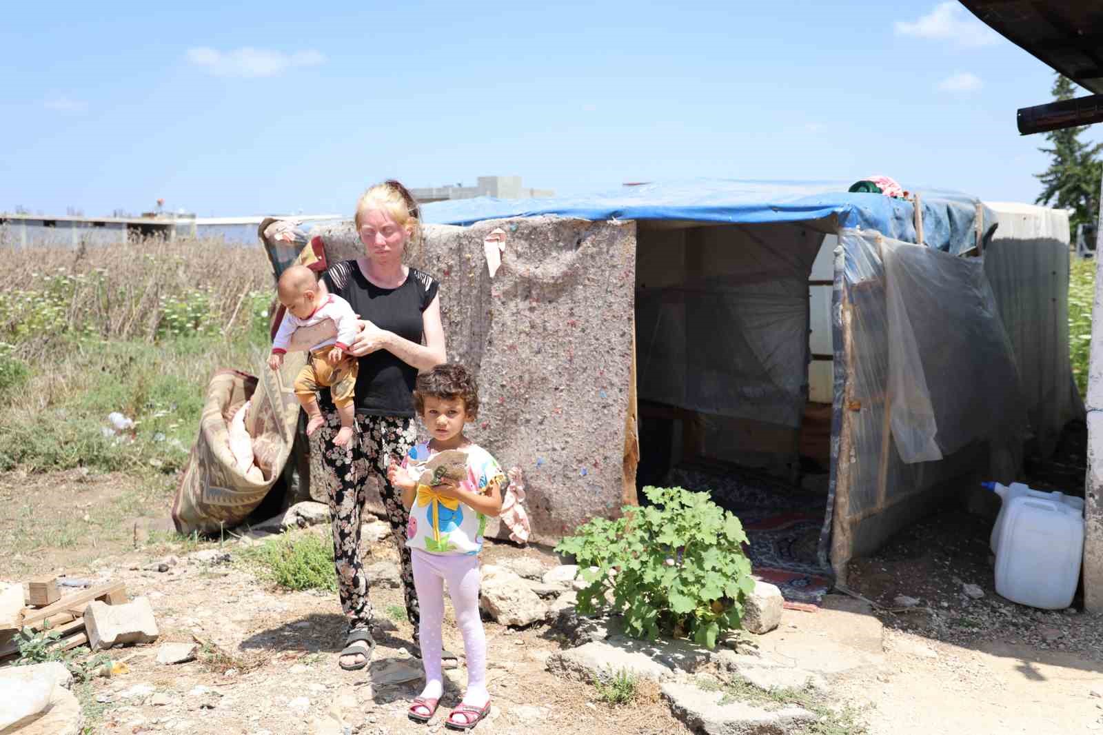 ‘Albino’ kadının Adana sıcağında yaşam mücadelesi
