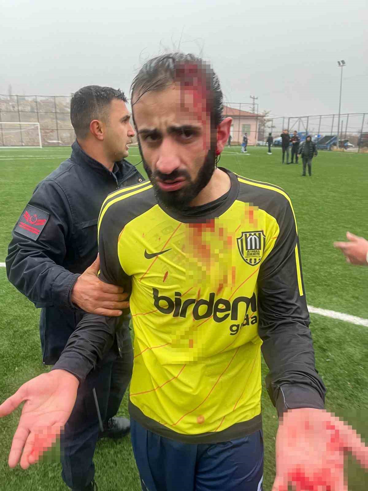 (DÜZELTME) Amatör maçta saha karıştı, futbolcular taşlı saldırıda yaralandı
