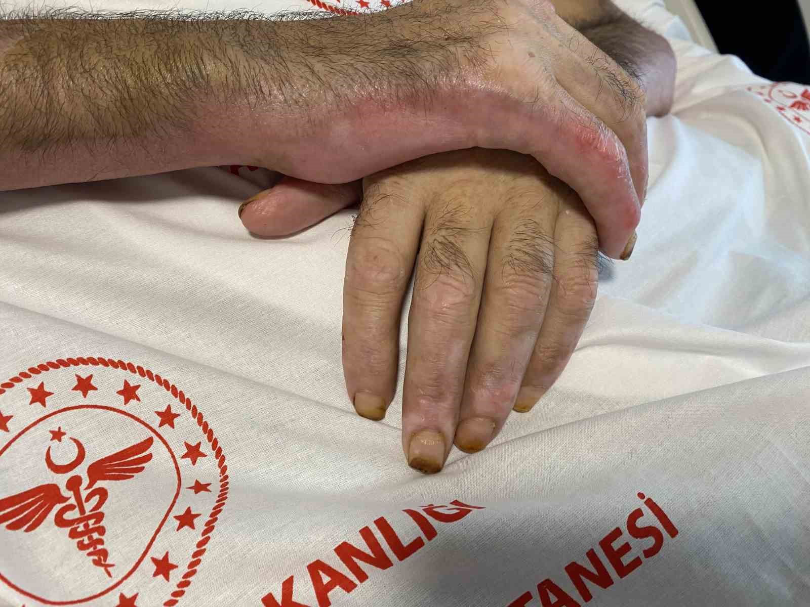 Mangal yapmak isterken ’Tiner faciası’: Vücudunun yüzde 80’i yandı, patlamanın şiddeti kameraya yansıdı
